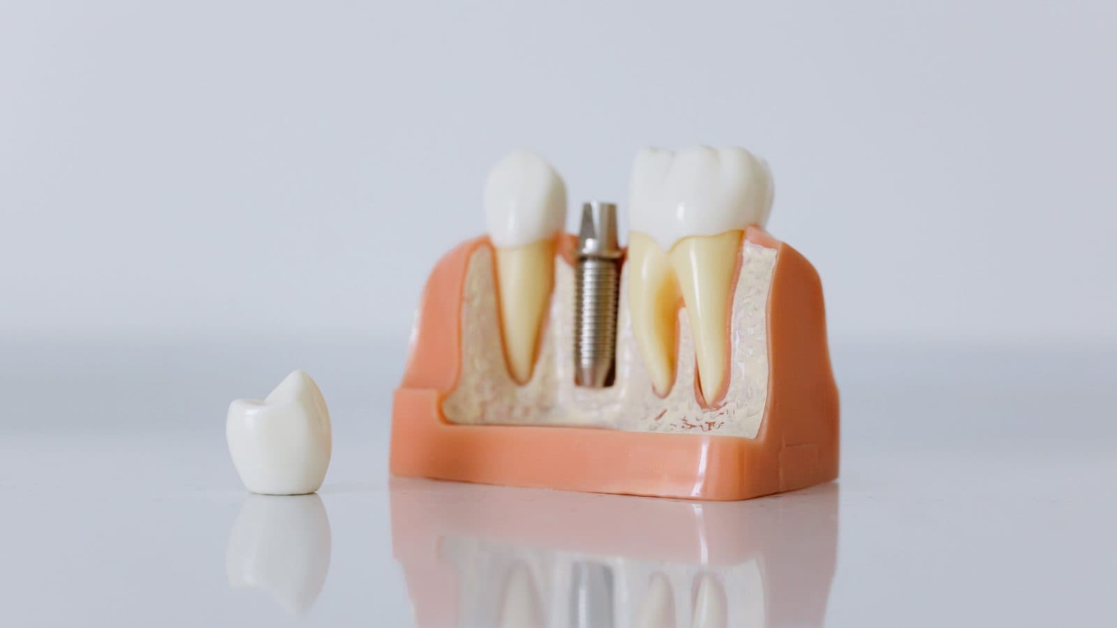 Comprehensive Dental Care in Culpeper, VA: Meet Dr. Elias Sanie, DDS at Culpeper Dental Care